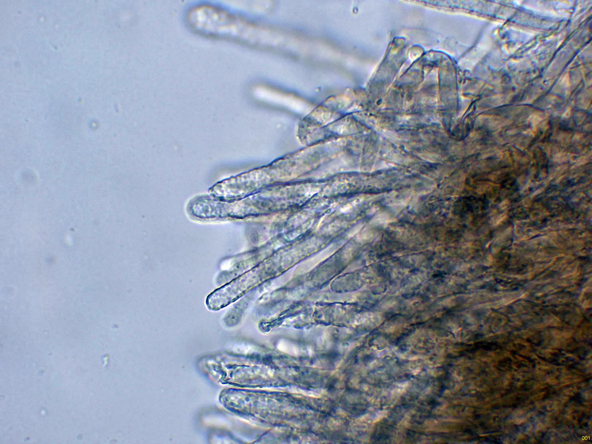 Microscopía de Fomes fomentarius - 10 - Hifas terminales agua-001